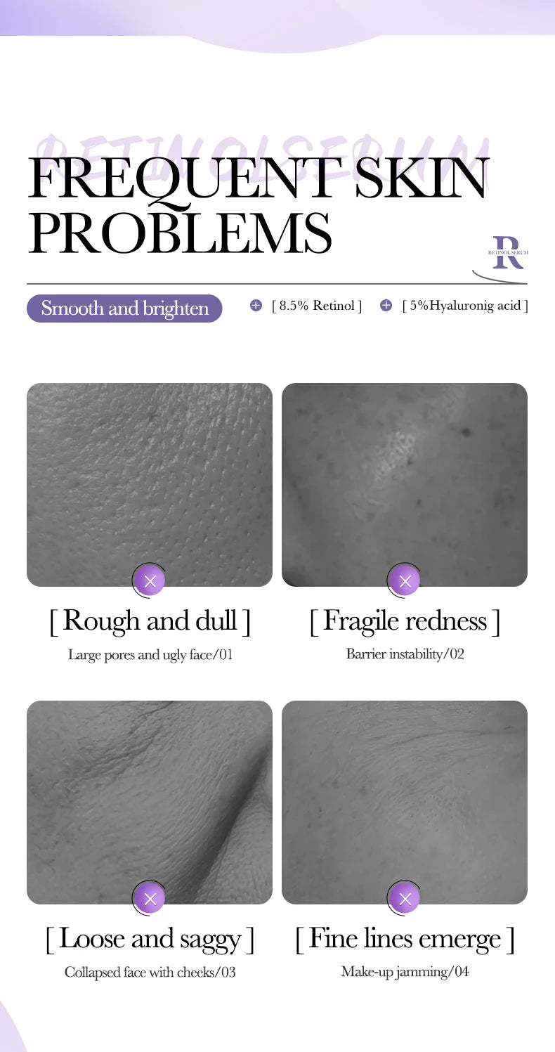 Sérum BIOAQUA con vitamina C, retinol y ácido hialurónico | Esencia facial premium