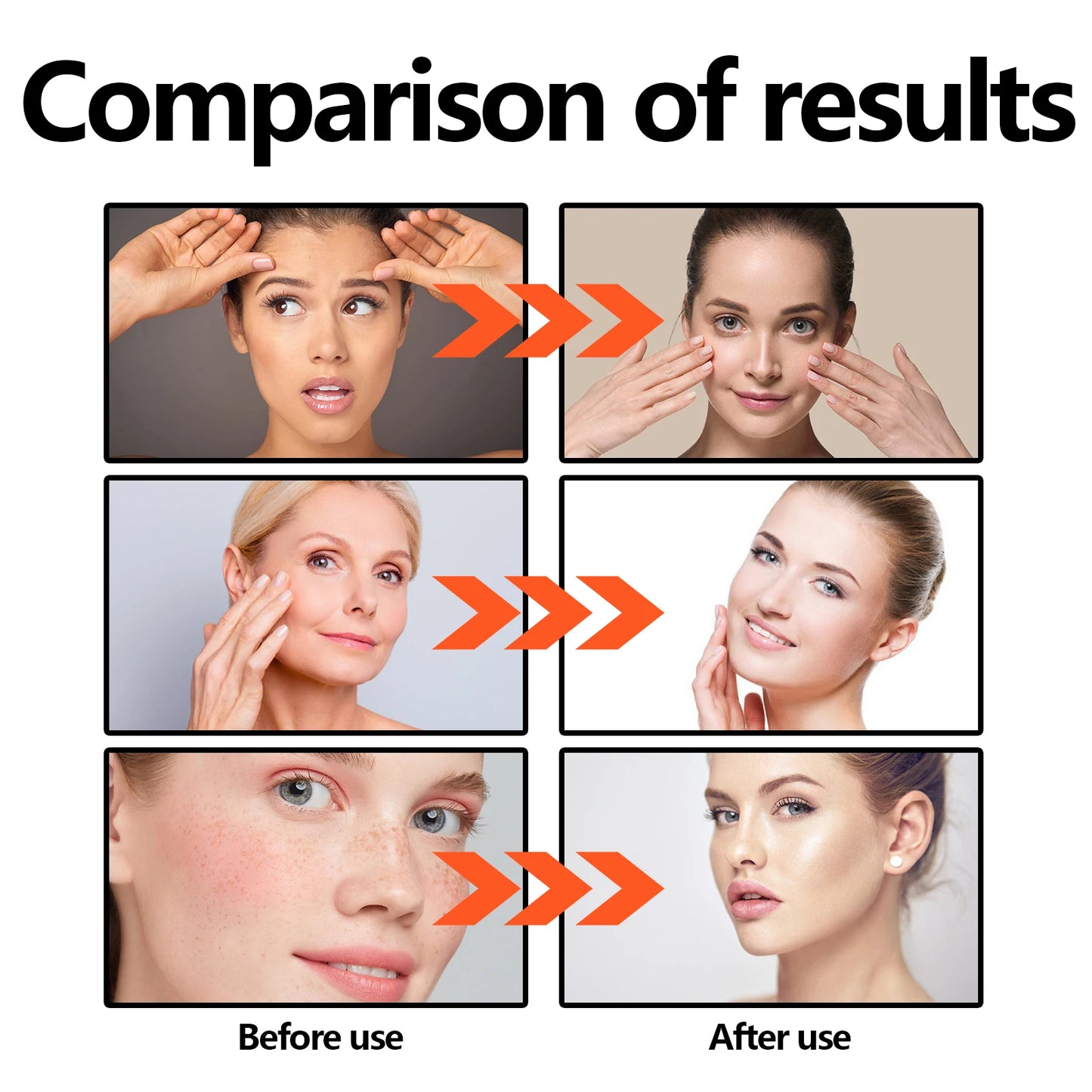 Suero facial con vitamina C 30 ml - Esencia hidratante y reafirmante
