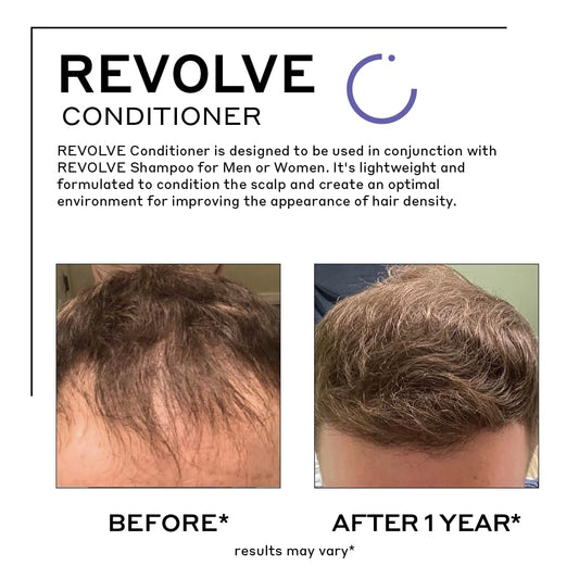Zenagen Revolve Conditioner – Lightweight Scalp Hydration for Fuller-Looking Hair