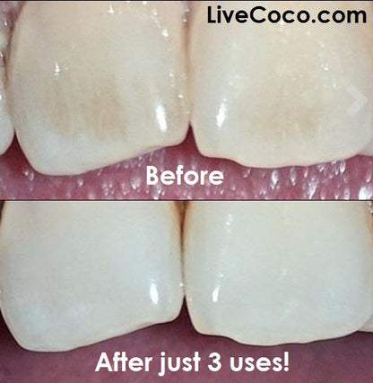 LiveCoco Activated Charcoal Teeth Cleaning Powder