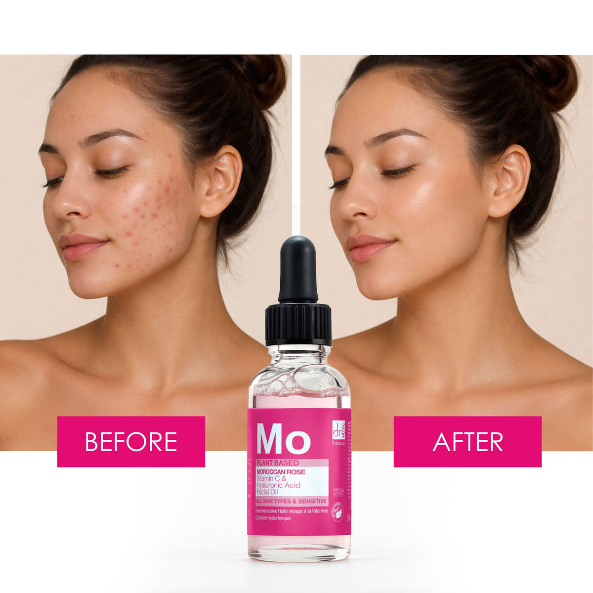 Dr Botanicals Moroccan Rose Facial Oil