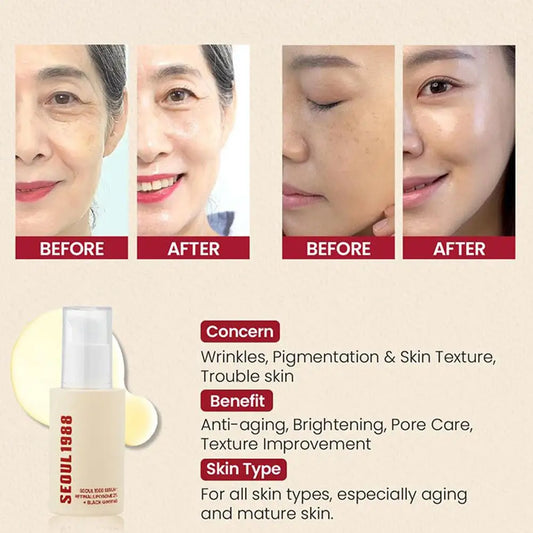Suero coreano SEÚL 1988