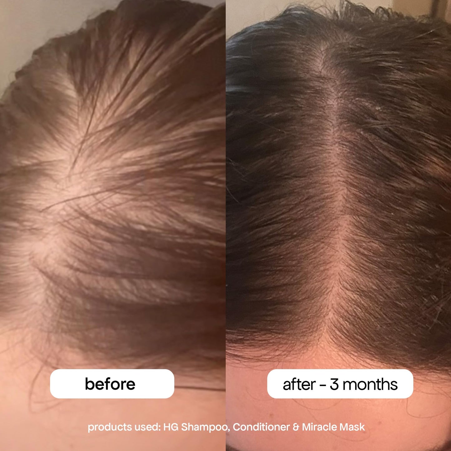 BONDIBOOST HG Anti-Thinning Shampoo — Mint, Vegan