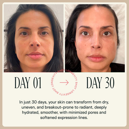 Happy Aging Liquid NAD+ Shot – Liposomal NR & Resveratrol | 30 Shots - Calm Era