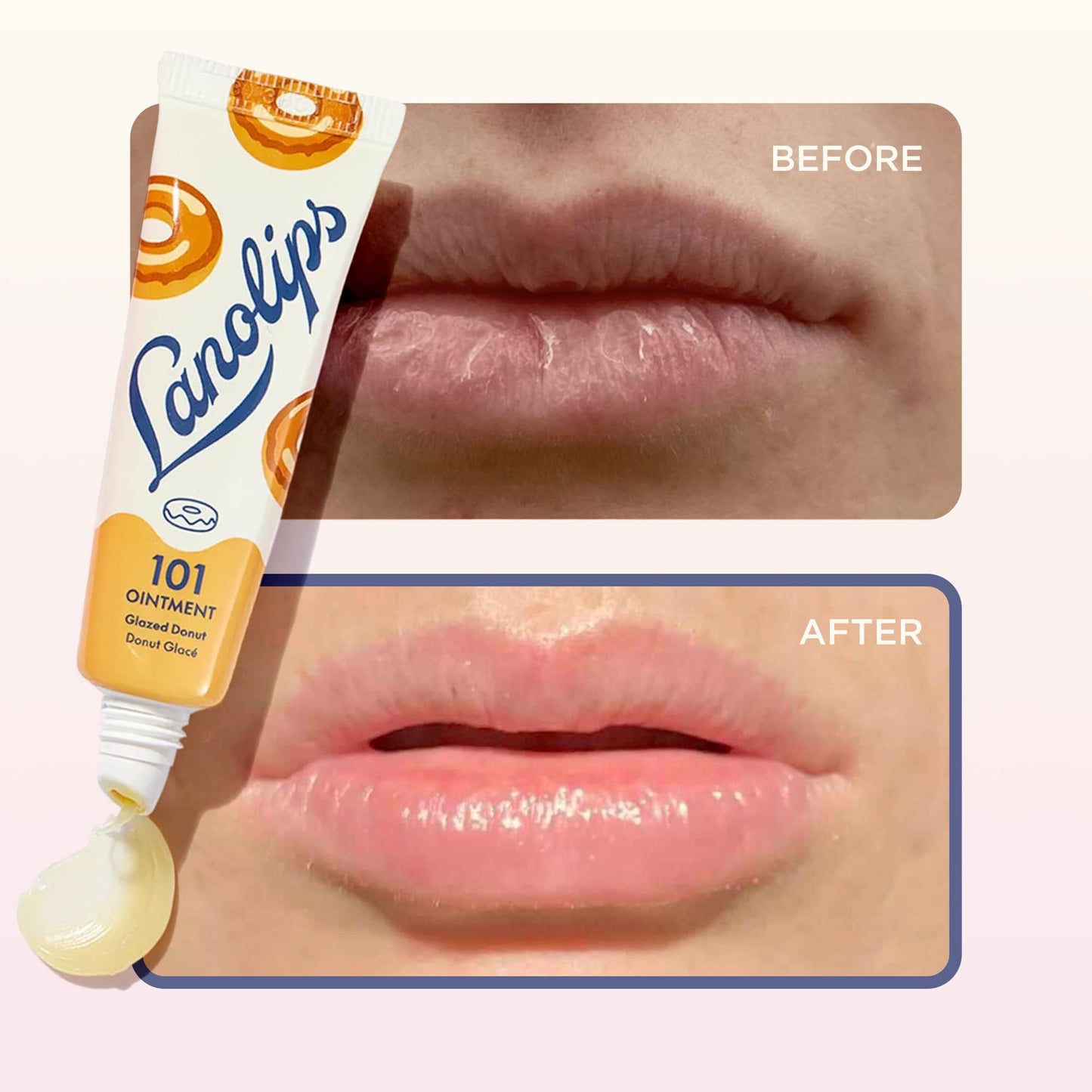 Lanolips 101 Ointment — Glazed Donut, Multipurpose Lip Balm, 0.52oz