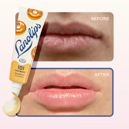 Lanolips 101 Ointment — Glazed Donut, Multipurpose Lip Balm, 0.52oz