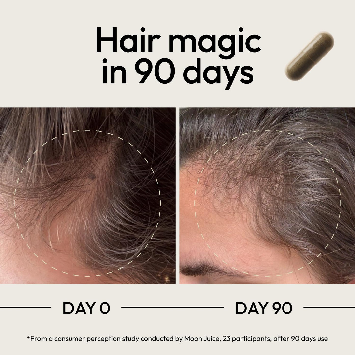 Moon Juice SuperHair – Hair Growth Vitamins for Women & Men