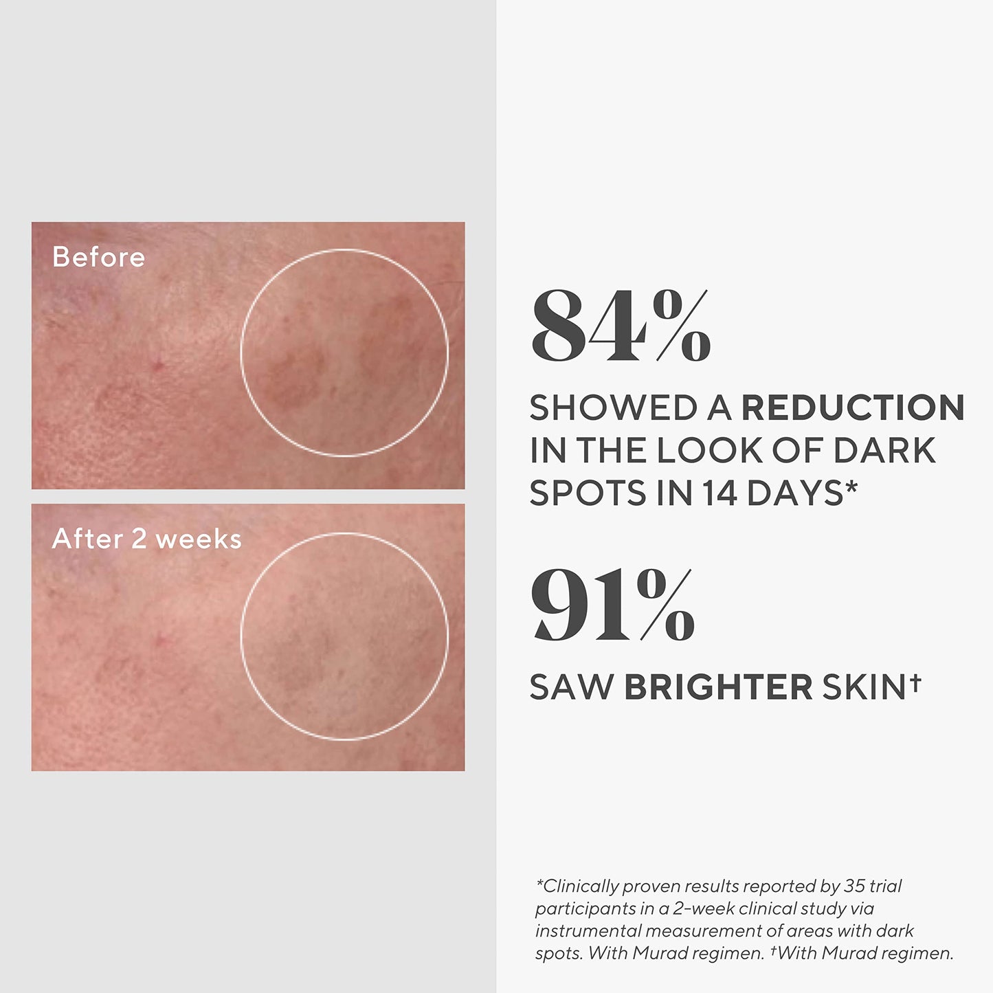 Murad Rapid Dark Spot Correcting Serum — Travel Size 0.33oz