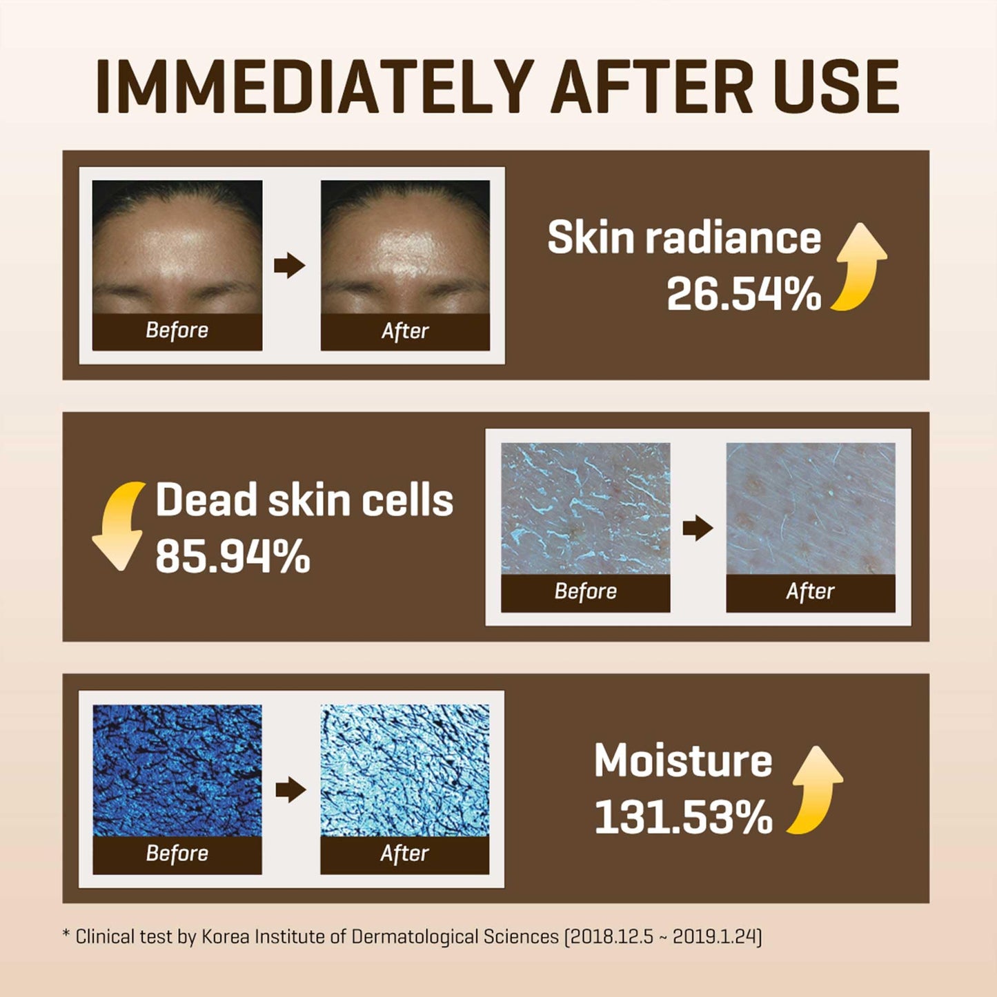 SOME BY MI Galactomyces Vitamin C Glow Toner — 200ml