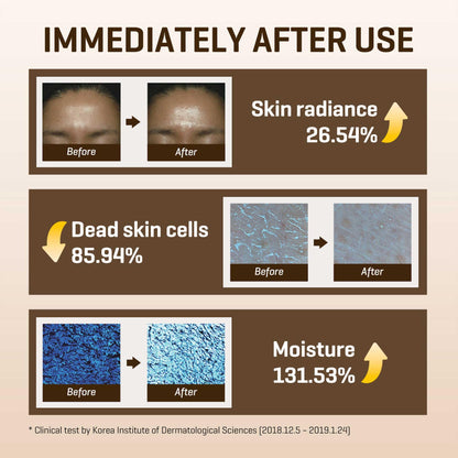 SOME BY MI Galactomyces Vitamin C Glow Toner — 200ml